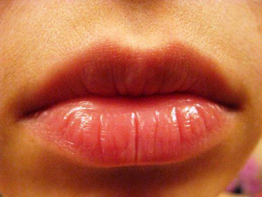 ¿Por qué los labios se queman?