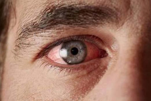 Retinopatía de la retina en la diabetes: síntomas y métodos de tratamiento